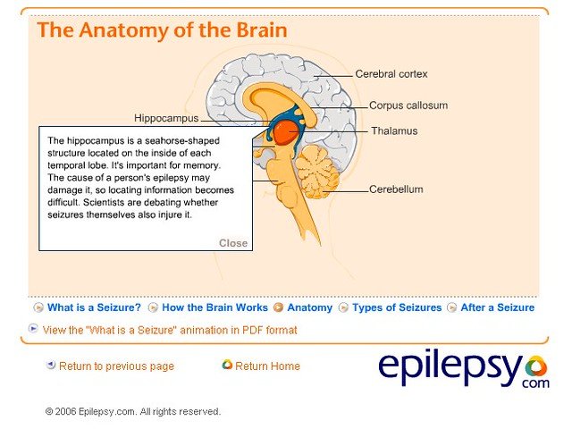 Understanding Epilepsy ⁤in Horses: Unraveling the Complexities of Neural Pathways