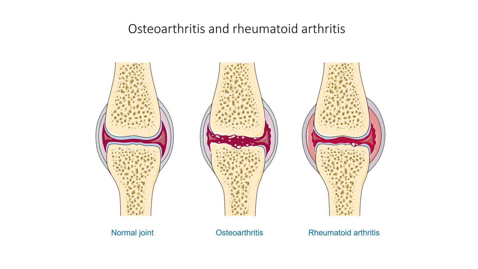 Arthritis Relief for Pets: Can CBD Help?